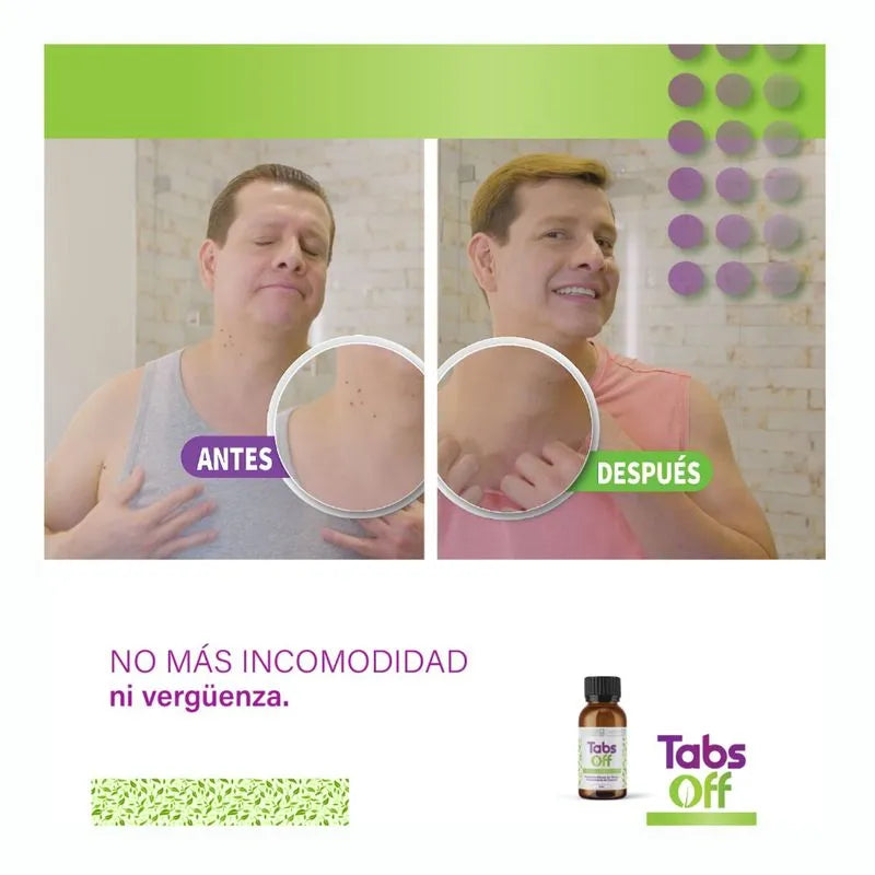 Tabs Off - Quita-verrugas
