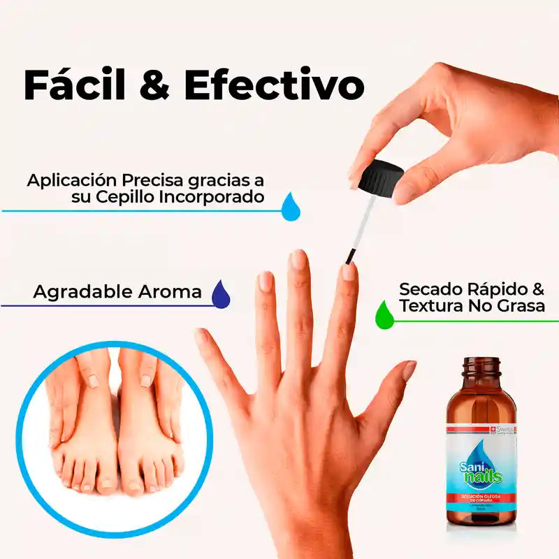 SaniNails Ayuda a Combatir Los Hongos de Tus Uñas